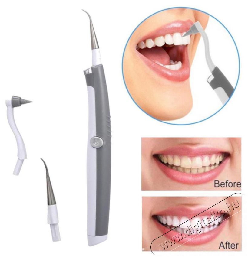 Alum Sonic Pic Fogtiszt&iacute;t&oacute; rendszer Sz&eacute;ps&eacute;g&aacute;pol&aacute;s / Eg&eacute;szs&eacute;g - Sz&aacute;j / fog &aacute;pol&aacute;s - Elektromos fogkefe - 524107