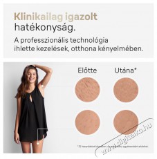 BRAUN IPL Silk-expert Pro 5 PL5382 + tok és 4 fej IPL szőrtelenítő Szépségápolás / Egészség - Szőrtelenítő / borotva - Női szőrtelenítő - 500986