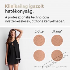BRAUN IPL Silk·expert Pro 5 PL5242 + tok és 3 fej Szépségápolás / Egészség - Szőrtelenítő / borotva - Női szőrtelenítő - 500992