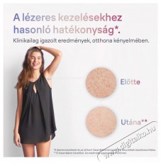BRAUN Smart IPL Skin I·Expert PL7253 + tok és 3 fej Villanófényes szőrtelenítő Szépségápolás / Egészség - Szőrtelenítő / borotva - Női szőrtelenítő - 509835