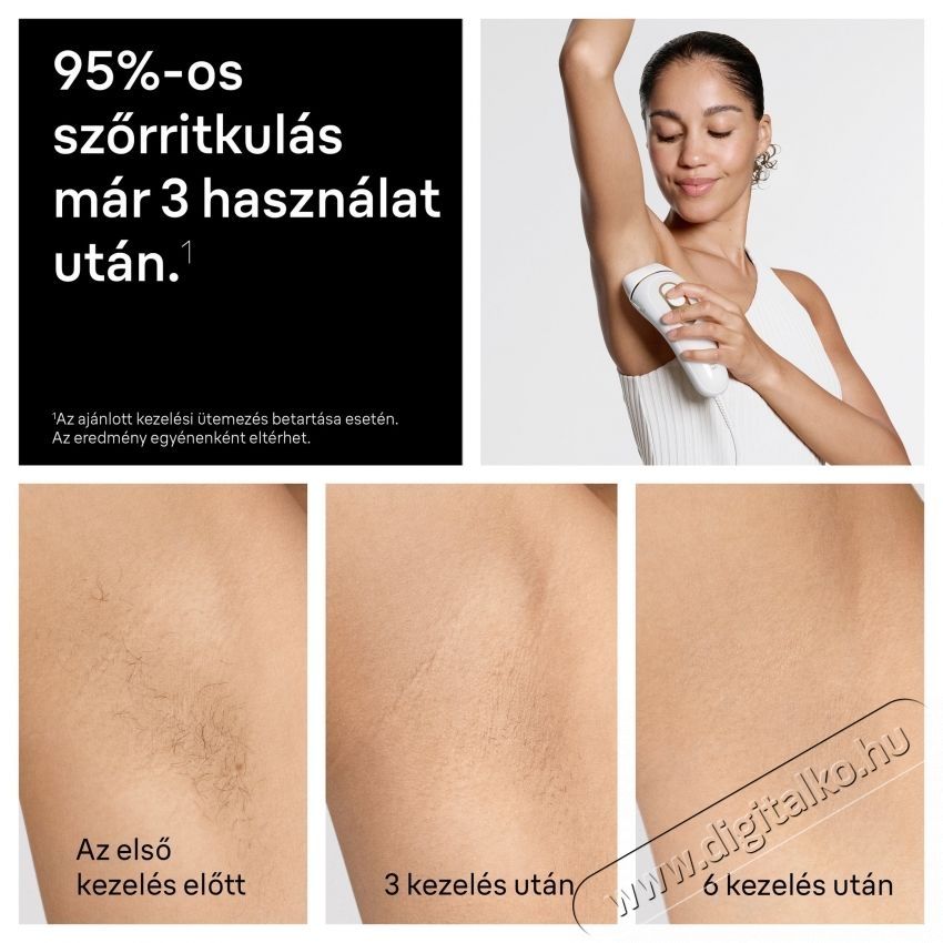 BRAUN IPL Silk-expert Pro 5 PL5221 Villan&oacute;f&eacute;nyes szőrtelen&iacute;tő Sz&eacute;ps&eacute;g&aacute;pol&aacute;s / Eg&eacute;szs&eacute;g - Szőrtelen&iacute;tő / borotva - Tart&oacute;s szőrtelen&iacute;tő - 540827