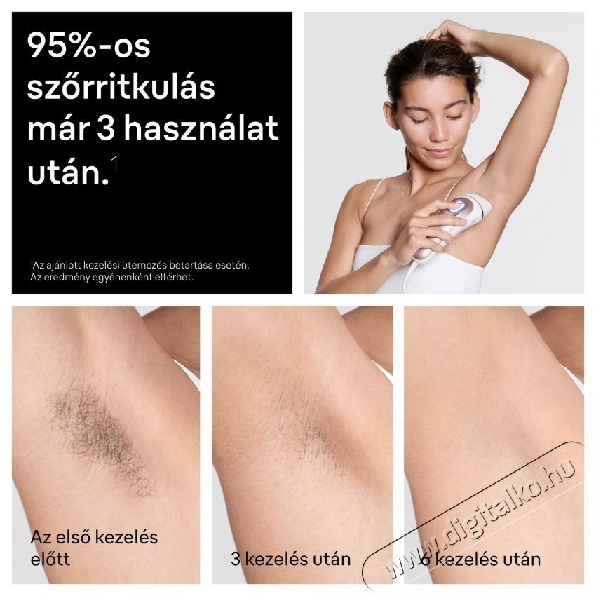 BRAUN Smart IPL Skin i-expert 7 PL7432 Villan&oacute;f&eacute;nyes szőrtelen&iacute;tő Sz&eacute;ps&eacute;g&aacute;pol&aacute;s / Eg&eacute;szs&eacute;g - Szőrtelen&iacute;tő / borotva - Tart&oacute;s szőrtelen&iacute;tő - 540825