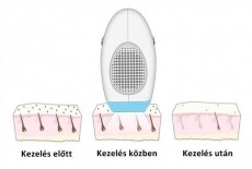 Deess IPL 300 szőrtelenítő Szépségápolás / Egészség - Szőrtelenítő / borotva - Tartós szőrtelenítő - 318533