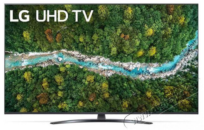 LG 43UP78003LB Ultra HD Smart LED telev&iacute;zi&oacute; + PL2 bluetooth hangsz&oacute;r&oacute; Telev&iacute;zi&oacute;k - LED telev&iacute;zi&oacute; - UHD 4K felbont&aacute;s&uacute; - 372234