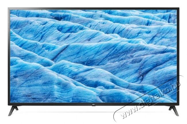 LG 70UM7100PLA Ultra HD Smart LED televízió Televíziók - LED televízió - UHD 4K felbontású - 349520