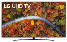 LG 70UP81003LR 4K Ultra HD Smart LED Televízió Televíziók - LED televízió - UHD 4K felbontású - 374207