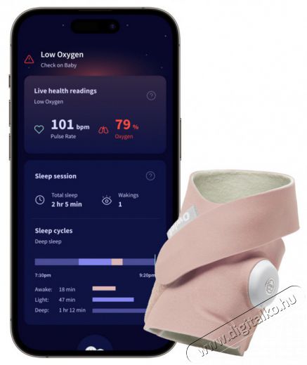 Owlet Dream Sock okos zokni 0-18 hónapig - Rózsaszín Szépségápolás / Egészség - Baba mama termék - Bébiőr / babafigyelő - 506170