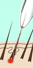 Rio CNHR2 elektrolízises szőrtelenítő Szépségápolás / Egészség - Szőrtelenítő / borotva - Női szőrtelenítő - 298415